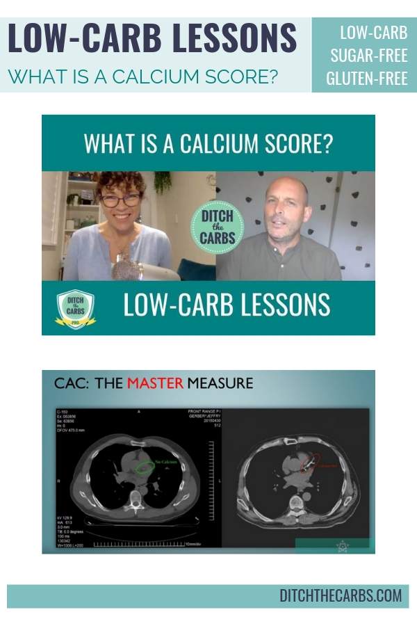 what is a calcium scan?