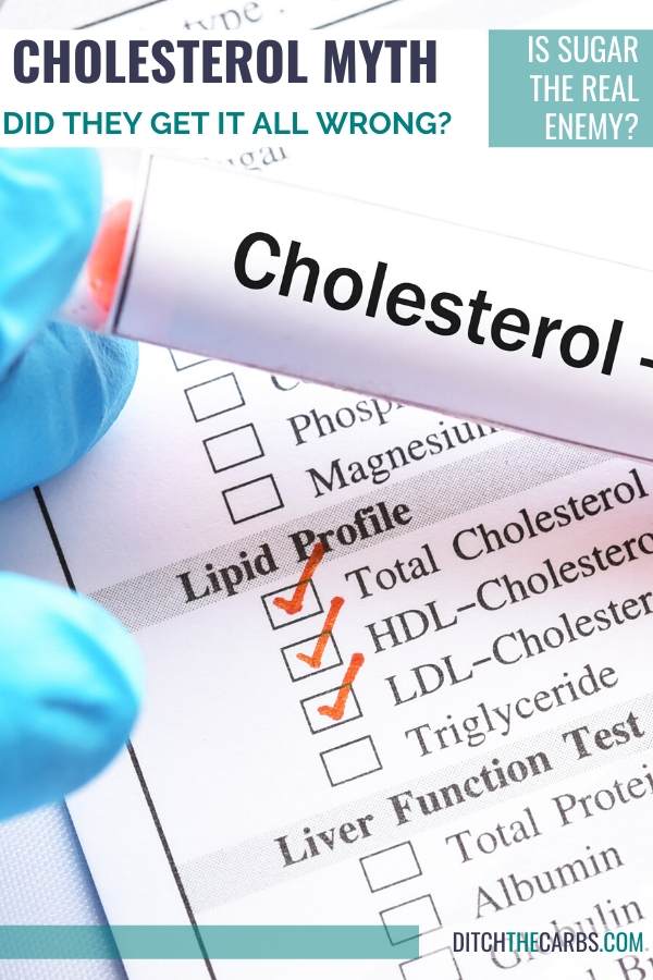 Mano enguantada con un kit de prueba de colesterol y los resultados