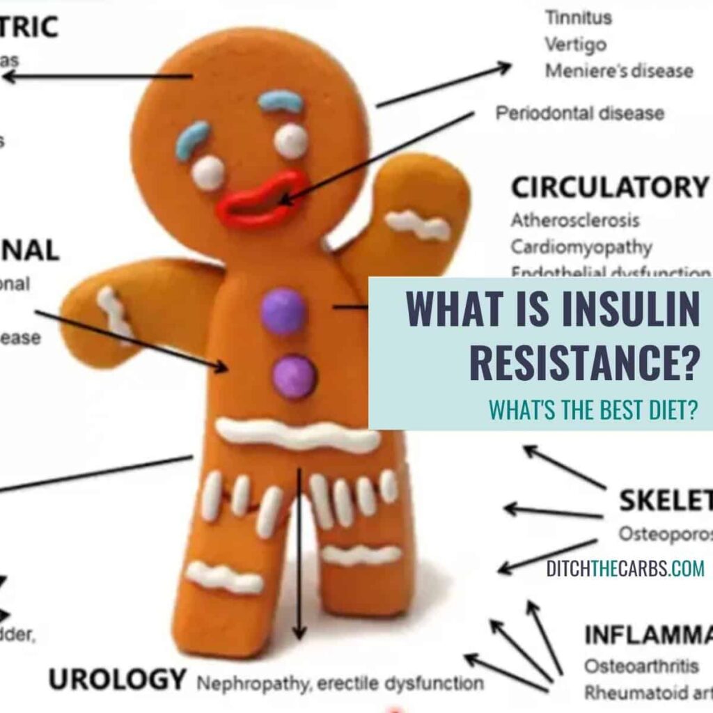 Insulin resistance meaning